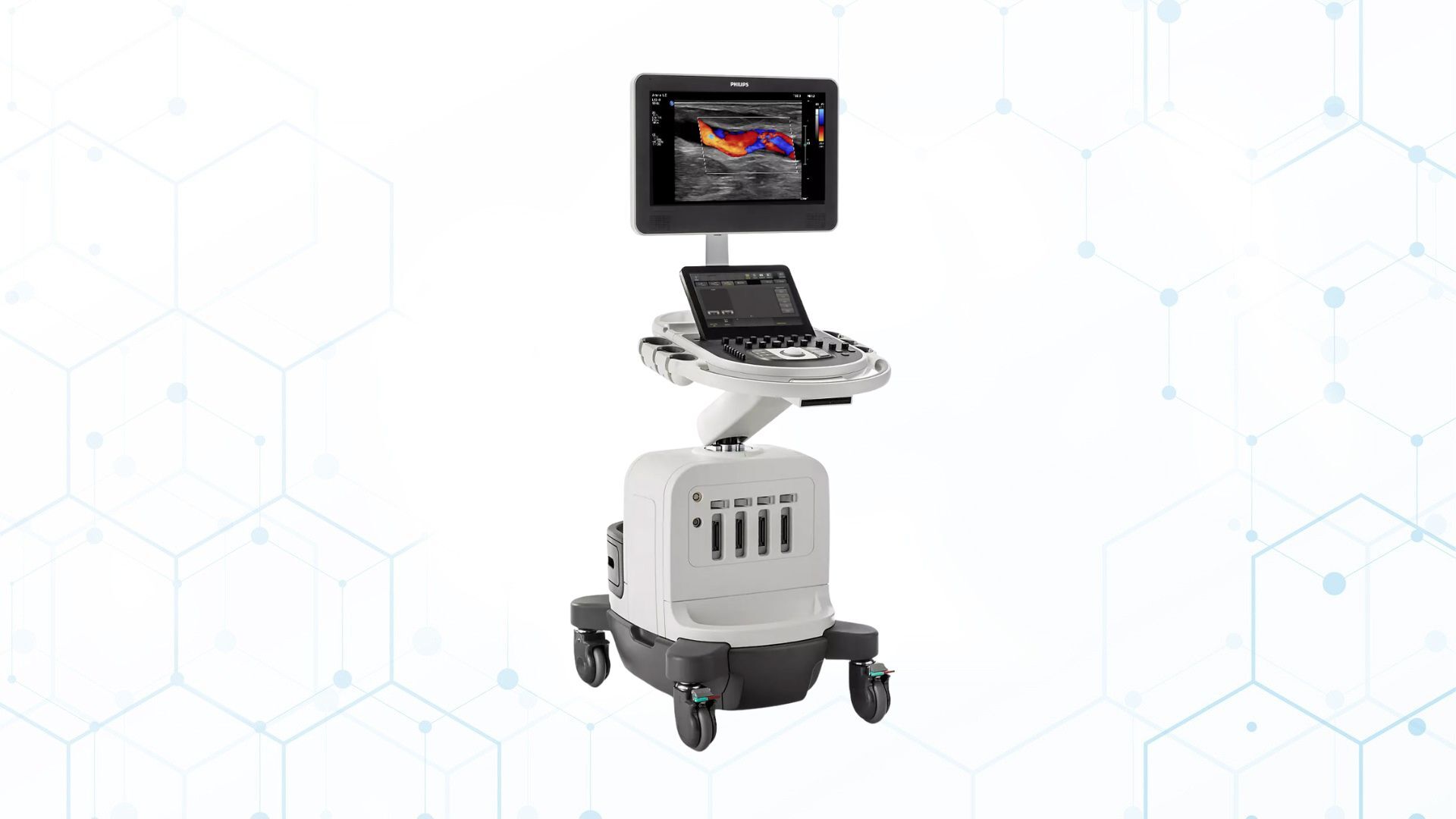 “Philips Affiniti 50 renkli Doppler ultrasonografi cihazı – damar ve yumuşak doku görüntüleme sistemi”